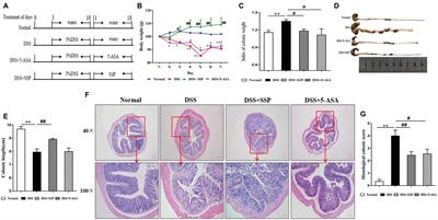 Sishen Pill Treatment of DSS-Induced Colitis via Regulating Interaction With Inflammatory Dendritic Cells and Gut Microbiota